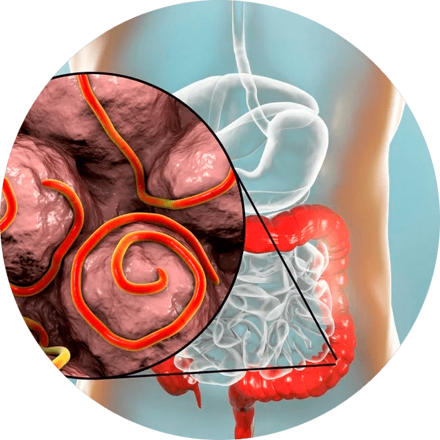Magen-Darm-Trakt und Parasiten
