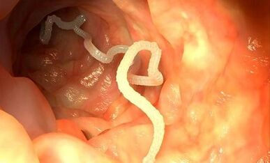 Ursachen für Parasiten im menschlichen Körper