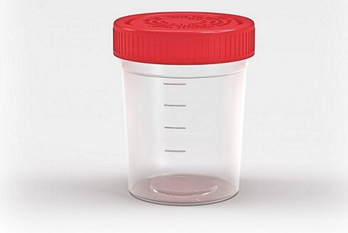 Behälter zum Testen auf Parasiten