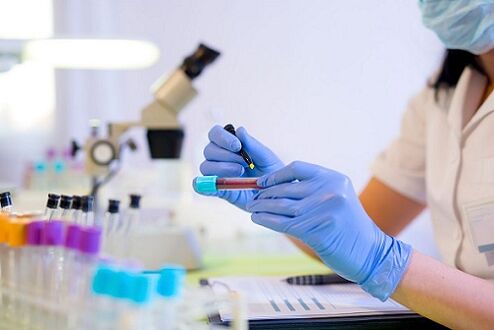 Bluttest auf Parasiten