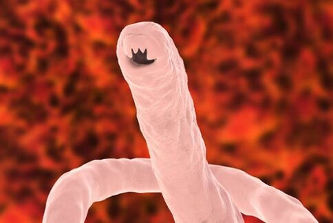 Wurmparasit des Menschen
