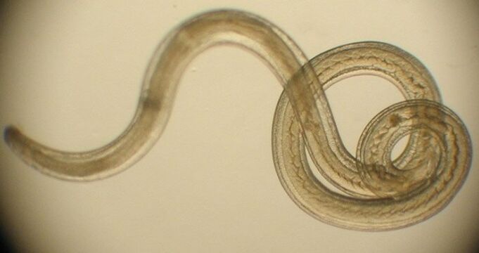 Wurmparasit aus dem menschlichen Körper